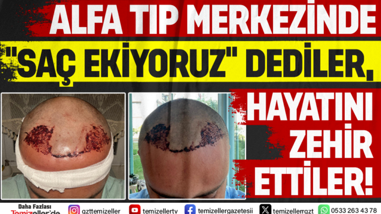 alfa-tip-merkezinde-sac-ekiyoruz-dediler-hayati-zehir-ettiler-6TR6FWOS.png